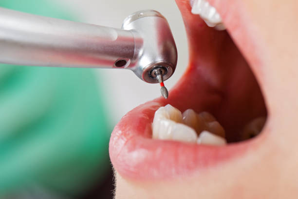 Best Cracked Tooth Emergency Dentist  in Granvle, IL